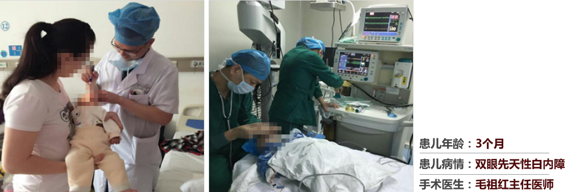 患兒年齡：3個(gè)月，患兒病情：雙眼先天性白內(nèi)障，手術(shù)醫(yī)生：毛祖紅主任醫(yī)師