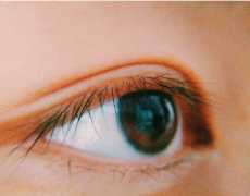 倒睫是由什么原因引起的？