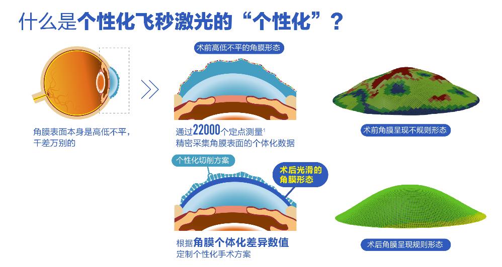 個性化微飛秒