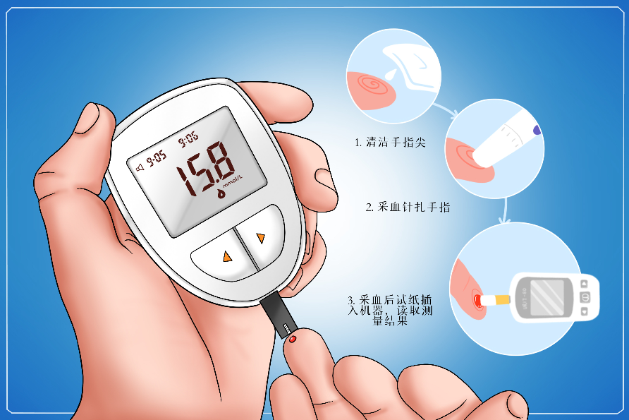 糖尿病視網(wǎng)膜病變