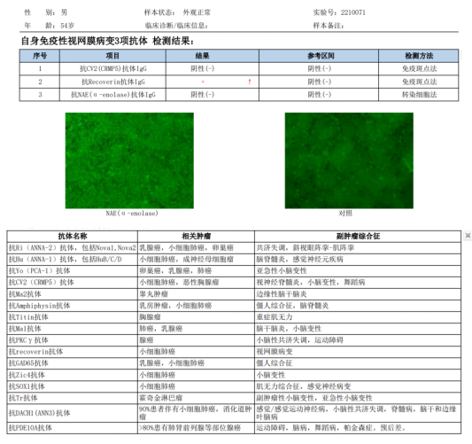 視網(wǎng)膜病變